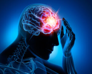 Why Choose Stanley Personal Injury Lawyers To Help Me Fight for Compensation After a Brain Injury in North Myrtle Beach?